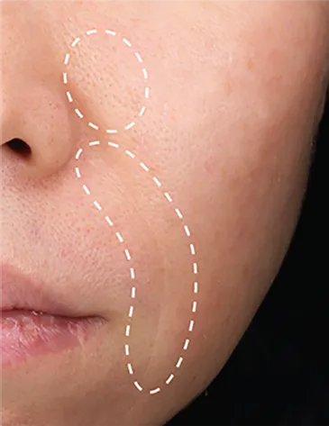 使用4週後，改善膚色不均、及細紋淡化