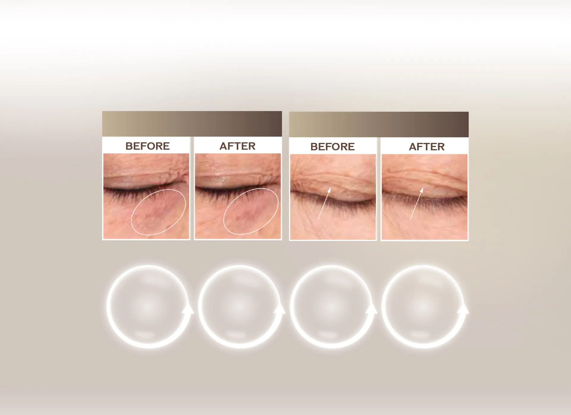 2倍亮眼 3倍緊緻 全面性眼部抗老