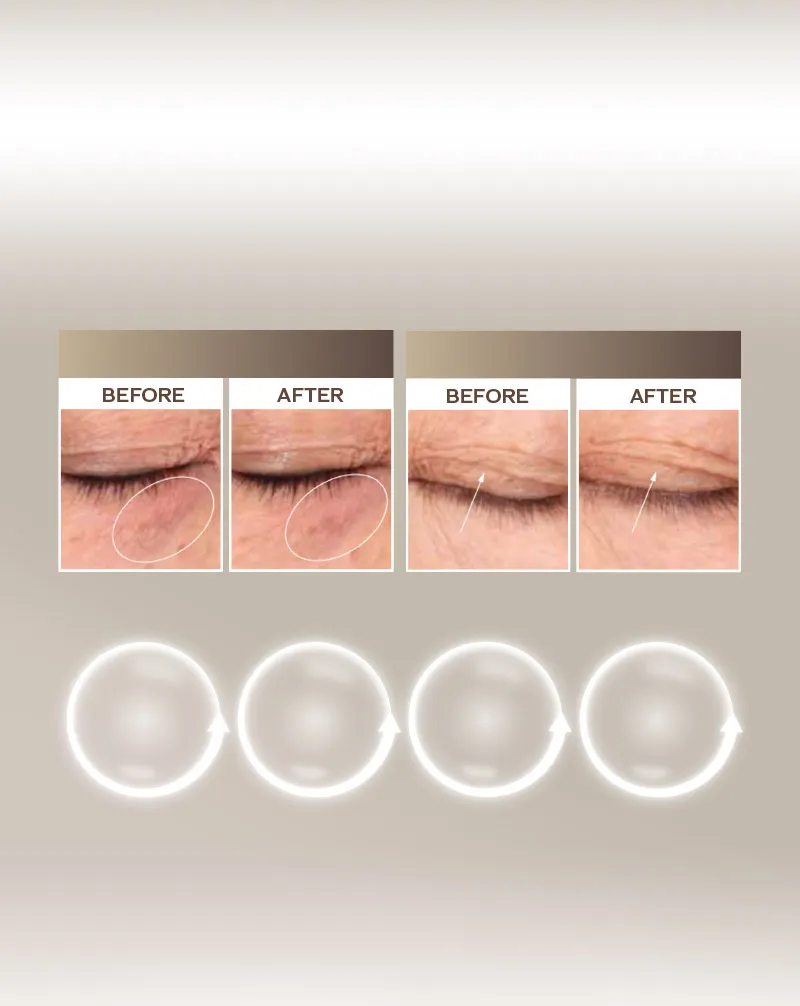 2倍亮眼 3倍緊緻 全面性眼部抗老