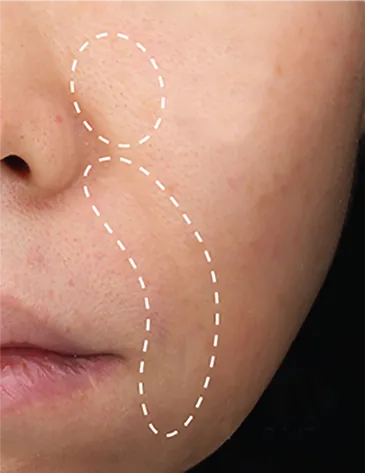 使用前8週後，膚色均勻、改善細紋